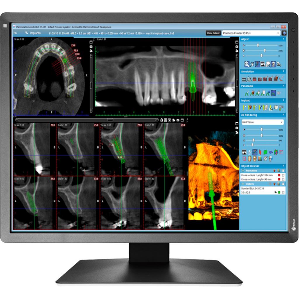 Монітор Eizo MX216-SB